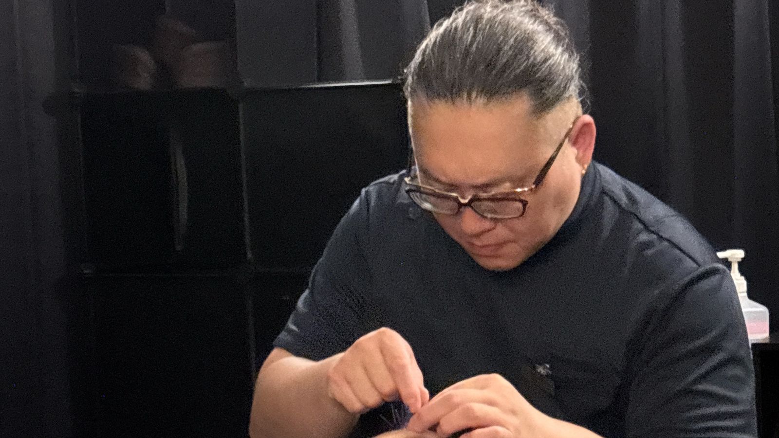 美容鍼の施術をする院長